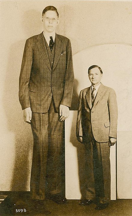 What is gigantism?